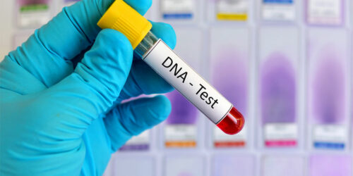 DNA Testing – Definition, Types, and Procedure