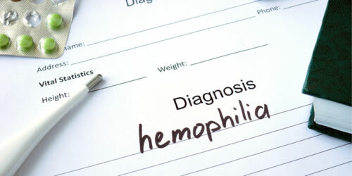 Hemophilia – Symptoms, Types, and Management Options