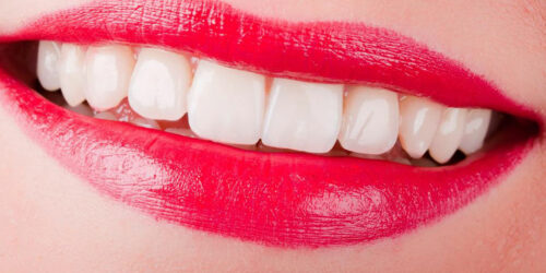4 useful tips for sparkling pearly white teeth
