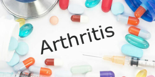 Arthritis – Classification and treatment