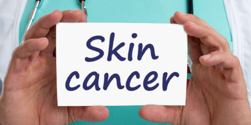 Skin Cancer – Types, Stages, and More