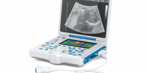 5 best portable ultrasound machines