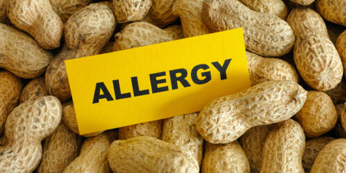 5 most common food allergies