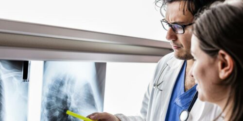 All You Need to Know about Lung Cancer