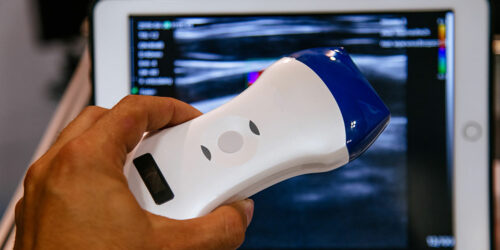 Benefits of portable ultrasound machines