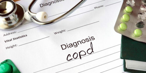 COPD – Symptoms, Risk Factors, and Stages