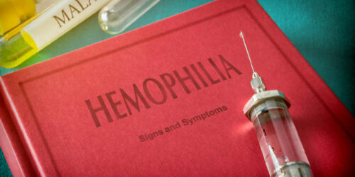 Hemophilia – Symptoms to look out for