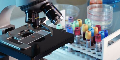 How to go about using an AncestryDNA test kit