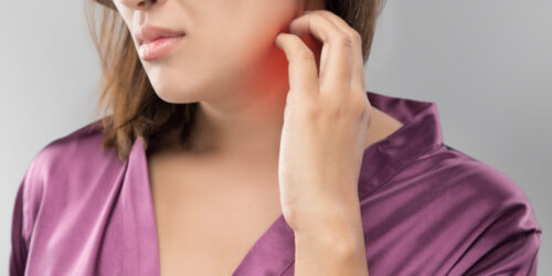 Shingles – Understanding The Condition