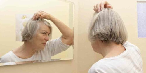 Thinning Hair Solutions – Watch Out Before It Is Too Late