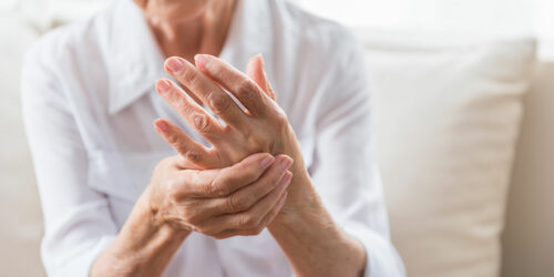 What you should know about arthritis as a joint condition