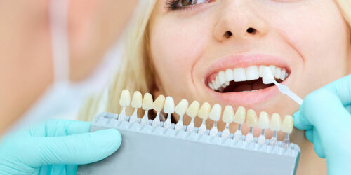 Dental Implants – Procedure and Cost