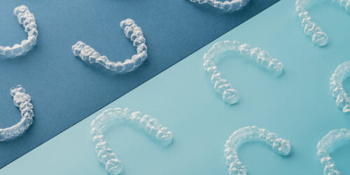 Factors That Affect the Cost of Invisible Dental Aligners