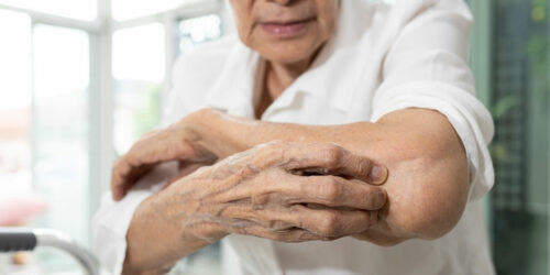 Itchy Skin in Seniors – Causes, Symptoms, and Management