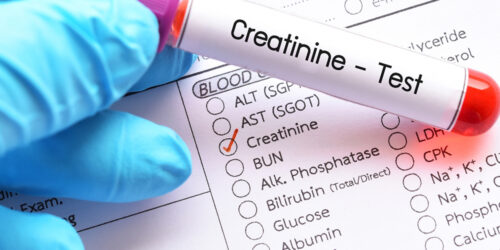 How to Analyze a Creatinine Level Chart